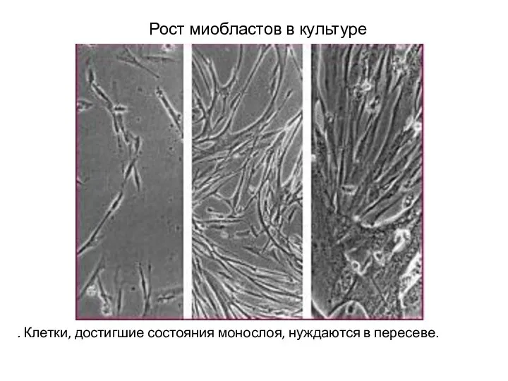 Рост миобластов в культуре . Клетки, достигшие состояния монослоя, нуждаются в пересеве.