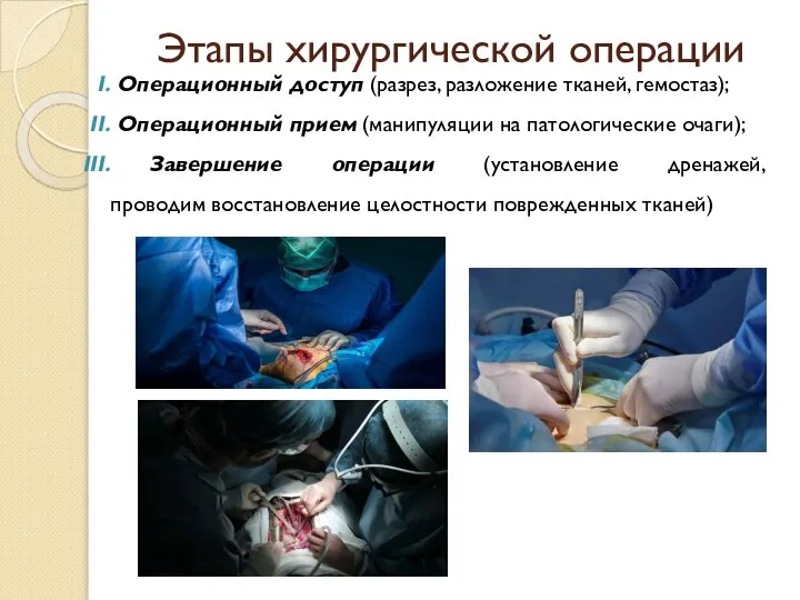 Этапы хирургической операции Операционный доступ (разрез, разложение тканей, гемостаз); Операционный прием (манипуляции