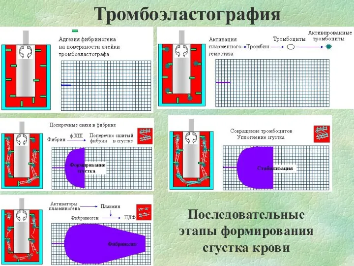 Тромбоэластография Последовательные этапы формирования сгустка крови