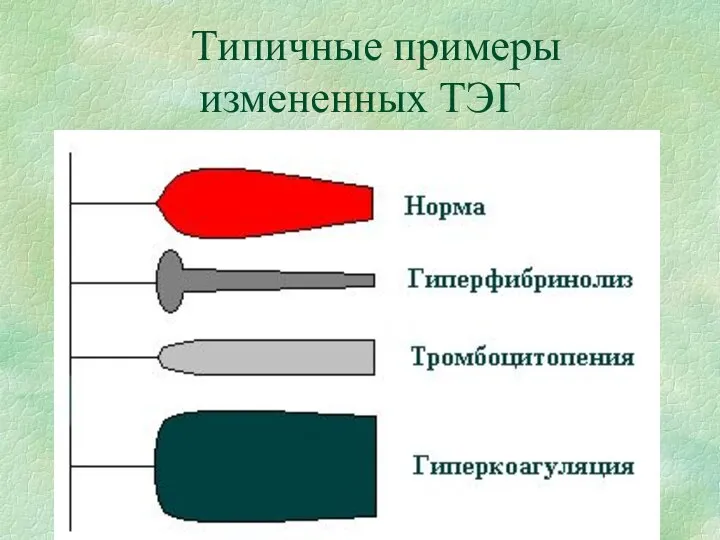 Типичные примеры измененных ТЭГ