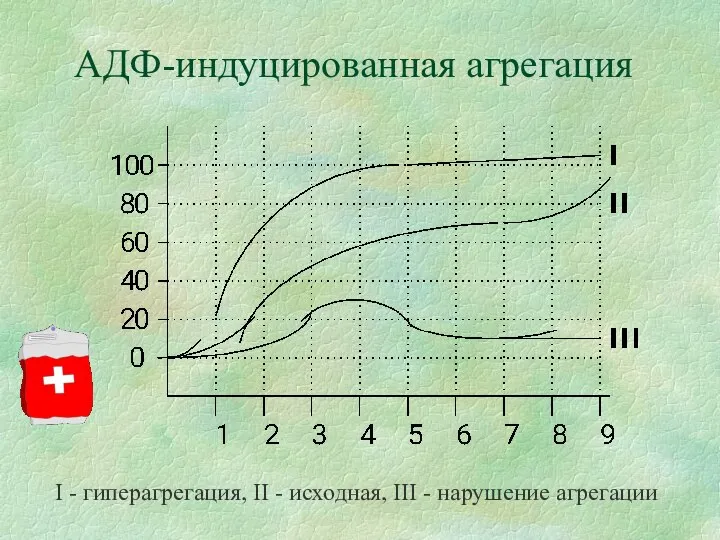 АДФ-индуцированная агрегация I - гиперагрегация, II - исходная, III - нарушение агрегации