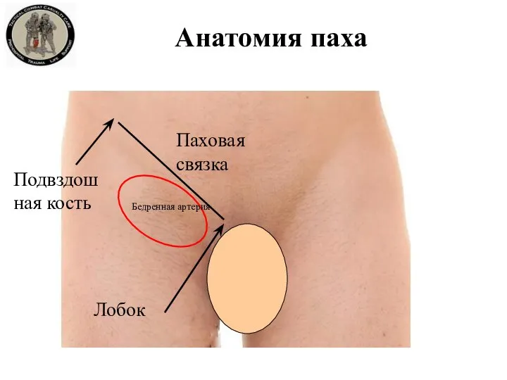 Анатомия паха Подвздошная кость Лобок Паховая связка Бедренная артерия