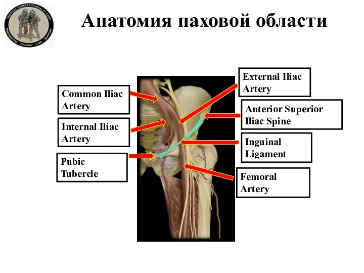 Анатомия паховой области Pubic Tubercle Anterior Superior Iliac Spine Femoral Artery External