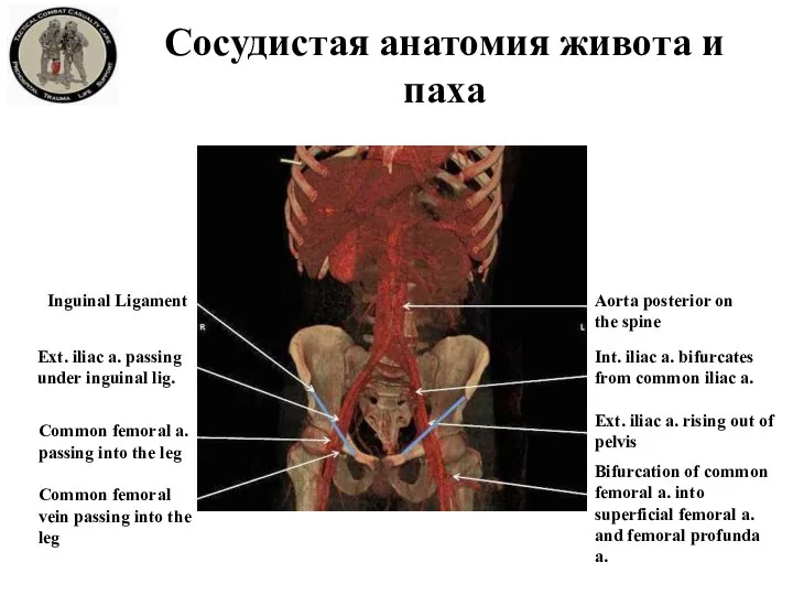 Inguinal Ligament Ext. iliac a. passing under inguinal lig. Aorta posterior on