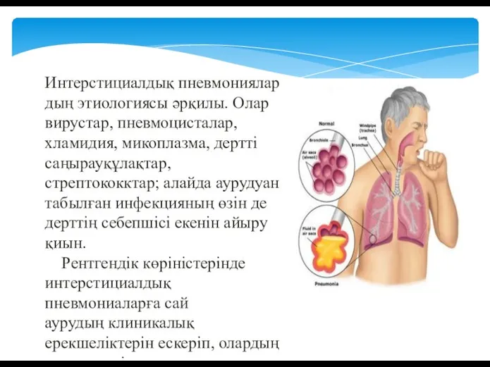 Интерстициалдық пневмониялардың этиологиясы әрқилы. Олар вирустар, пневмоцисталар, хламидия, микоплазма, дертті саңырауқұлақтар, стрептококктар;