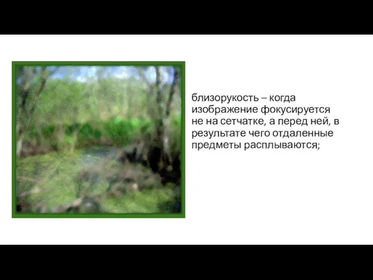 близорукость – когда изображение фокусируется не на сетчатке, а перед ней, в