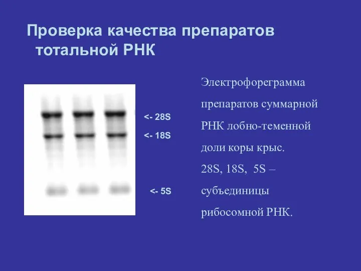 Проверка качества препаратов тотальной РНК Электрофореграмма препаратов суммарной РНК лобно-теменной доли коры