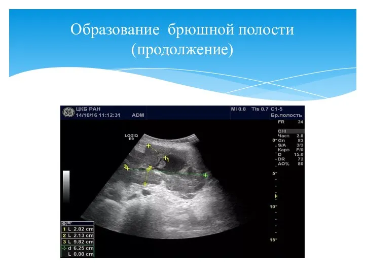 Образование брюшной полости (продолжение)