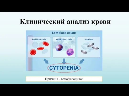 Клинический анализ крови Причина - гемофагоцитоз