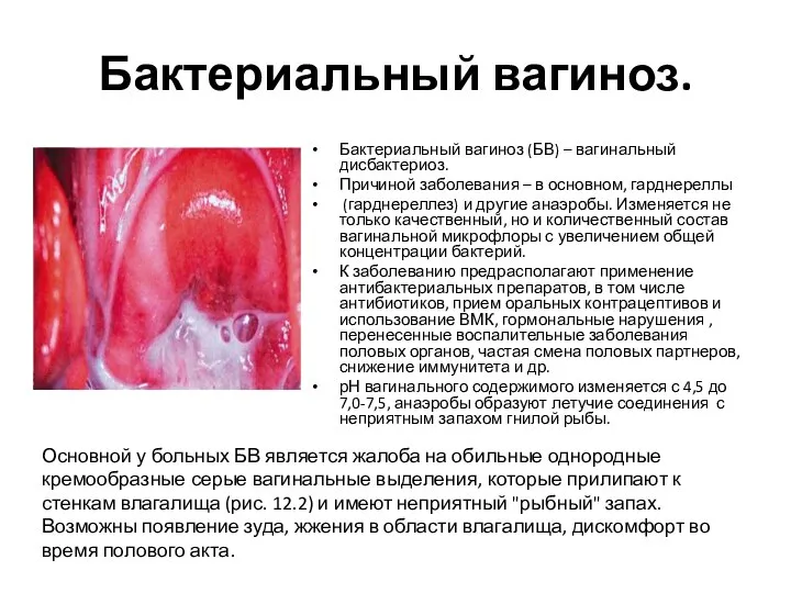 Бактериальный вагиноз. Бактериальный вагиноз (БВ) – вагинальный дисбактериоз. Причиной заболевания – в