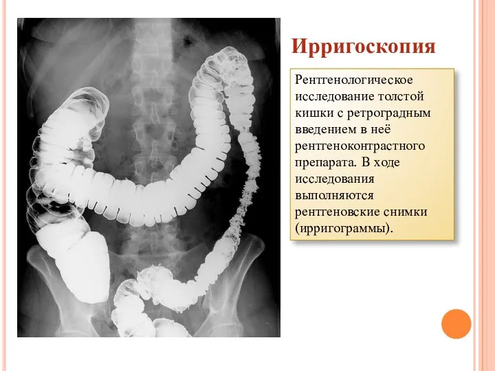 Ирригоскопия Рентгенологическое исследование толстой кишки с ретроградным введением в неё рентгеноконтрастного препарата.