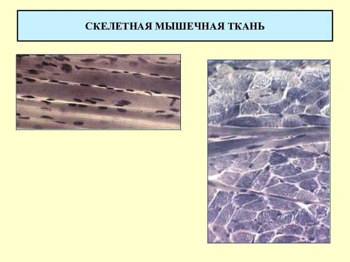 СКЕЛЕТНАЯ МЫШЕЧНАЯ ТКАНЬ