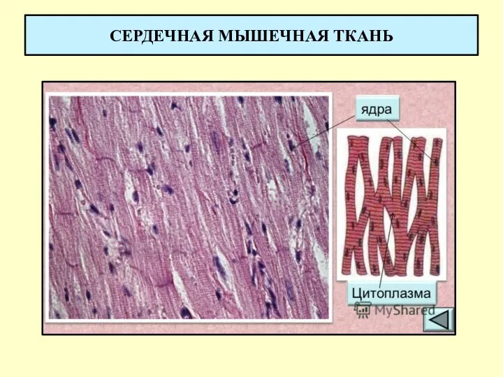 СЕРДЕЧНАЯ МЫШЕЧНАЯ ТКАНЬ