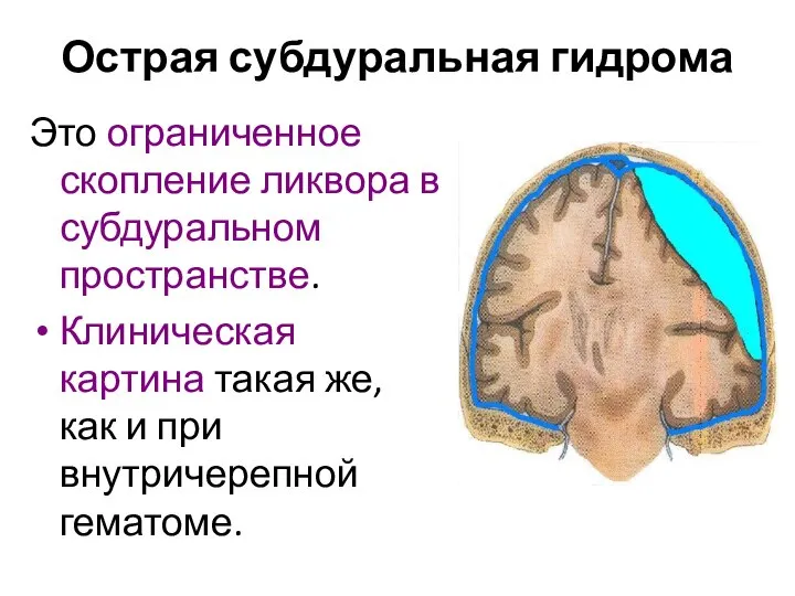 Острая субдуральная гидрома Это ограниченное скопление ликвора в субдуральном пространстве. Клиническая картина