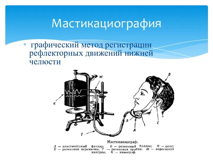 графический метод регистрации рефлекторных движений нижней челюсти Мастикациография