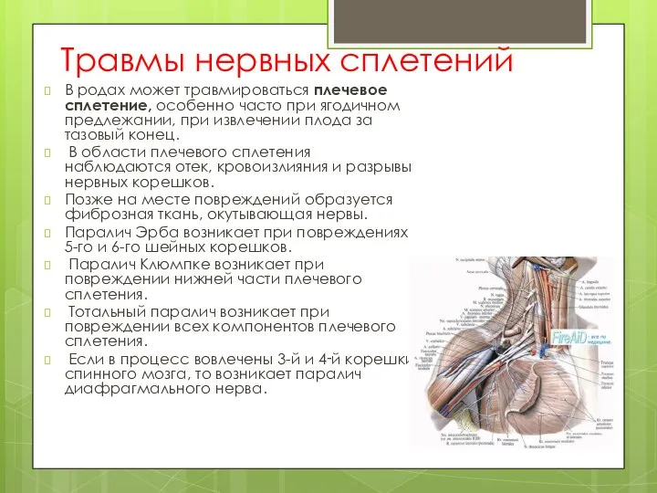 Травмы нервных сплетений В родах может травмироваться плечевое сплетение, особенно часто при