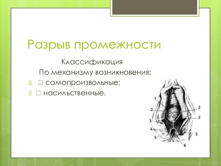 Разрыв промежности Классификация По механизму возникновения:  самопроизвольные;  насильственные.