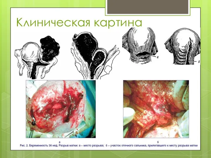 Клиническая картина