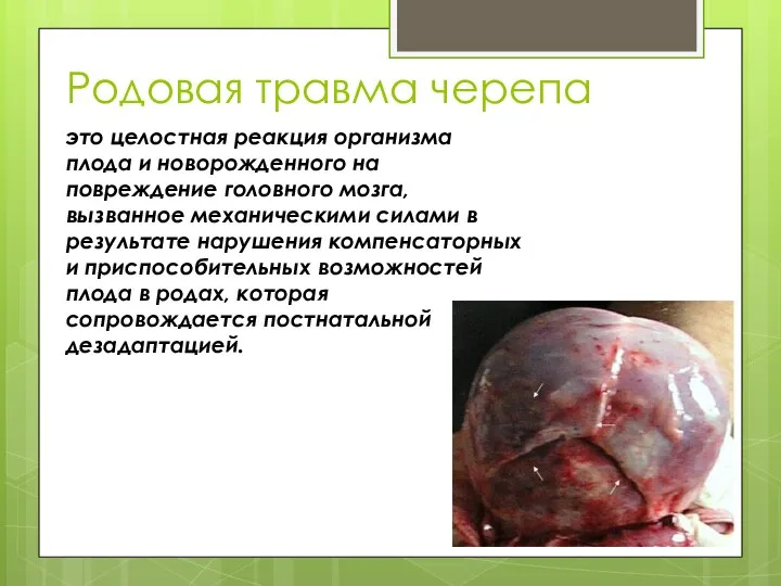 Родовая травма черепа это целостная реакция организма плода и новорожденного на повреждение