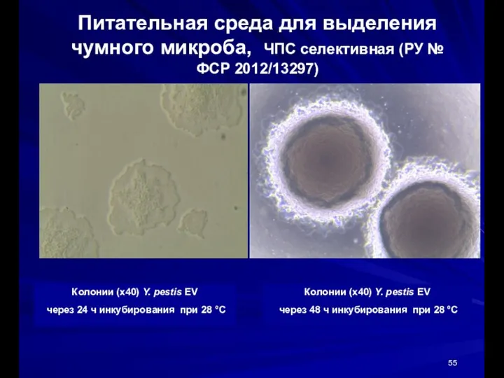 Питательная среда для выделения чумного микроба, ЧПС селективная (РУ № ФСР 2012/13297)