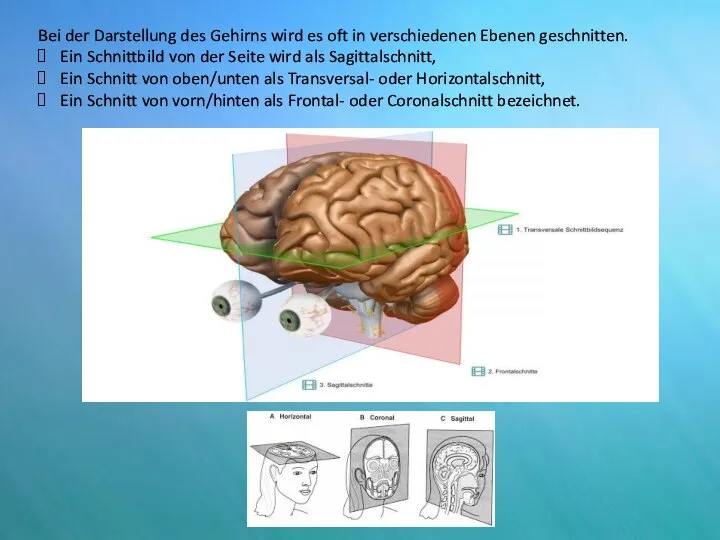 Bei der Darstellung des Gehirns wird es oft in verschiedenen Ebenen geschnitten.