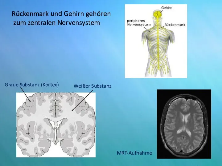 Rückenmark und Gehirn gehören zum zentralen Nervensystem Graue Substanz (Kortex) Weißer Substanz MRT-Aufnahme