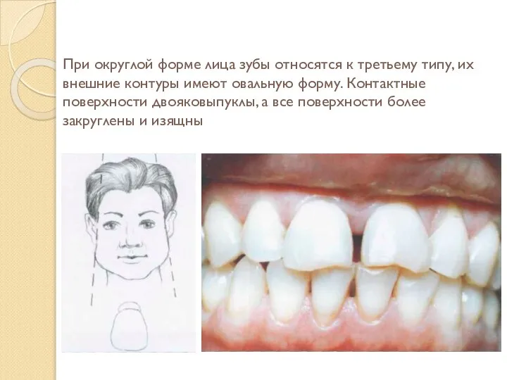 При округлой форме лица зубы относятся к третьему типу, их внешние контуры