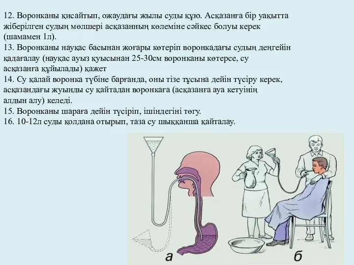 12. Воронканы қисайтып, ожаудағы жылы суды құю. Асқазанға бір уақытта жіберілген судың