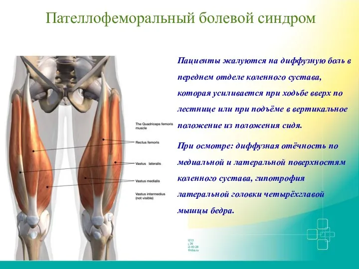 Пателлофеморальный болевой синдром Пациенты жалуются на диффузную боль в переднем отделе коленного