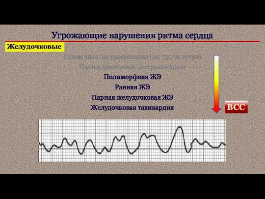 Угрожающие нарушения ритма сердца Желудочковые Одиночная экстрасистолия (до 750 за сутки) Частая