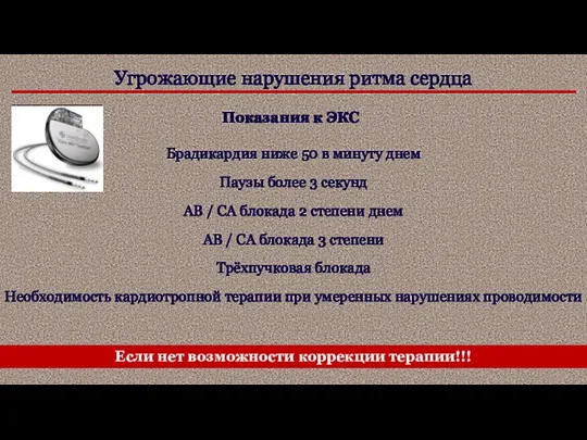 Угрожающие нарушения ритма сердца Показания к ЭКС Брадикардия ниже 50 в минуту