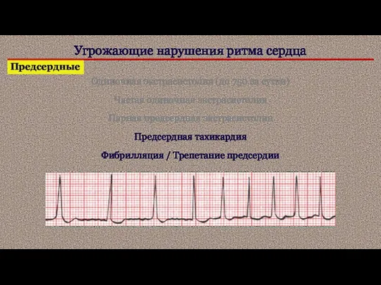 Угрожающие нарушения ритма сердца Предсердные Одиночная экстрасистолия (до 750 за сутки) Частая