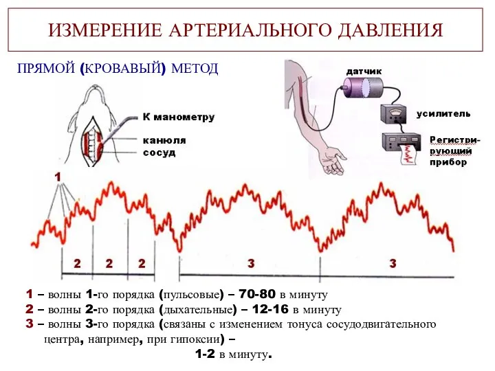 ИЗМЕРЕНИЕ АРТЕРИАЛЬНОГО ДАВЛЕНИЯ ПРЯМОЙ (КРОВАВЫЙ) МЕТОД 1 – волны 1-го порядка (пульсовые)