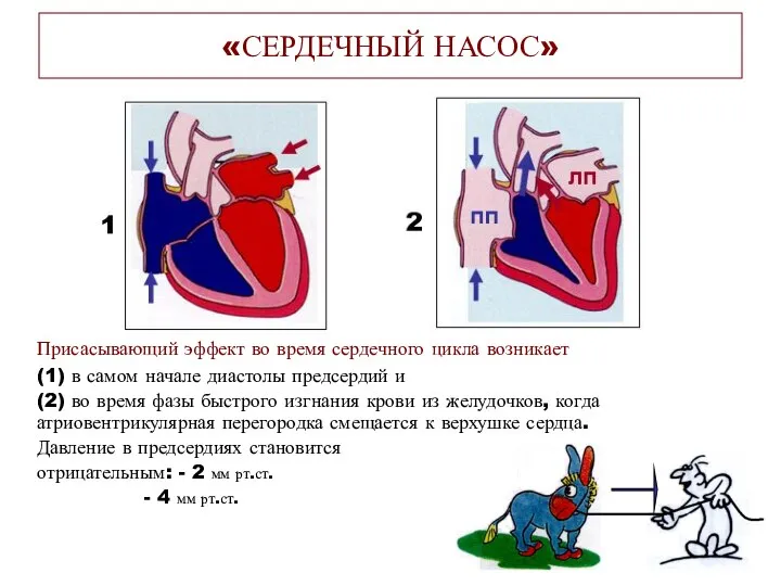 Присасывающий эффект во время сердечного цикла возникает (1) в самом начале диастолы