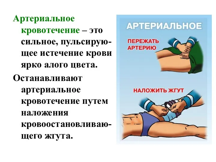 Артериальное кровотечение – это сильное, пульсирую-щее истечение крови ярко алого цвета. Останавливают