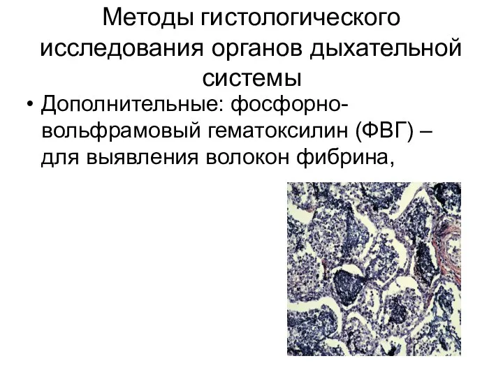 Методы гистологического исследования органов дыхательной системы Дополнительные: фосфорно-вольфрамовый гематоксилин (ФВГ) – для выявления волокон фибрина,