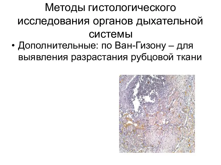 Методы гистологического исследования органов дыхательной системы Дополнительные: по Ван-Гизону – для выявления разрастания рубцовой ткани