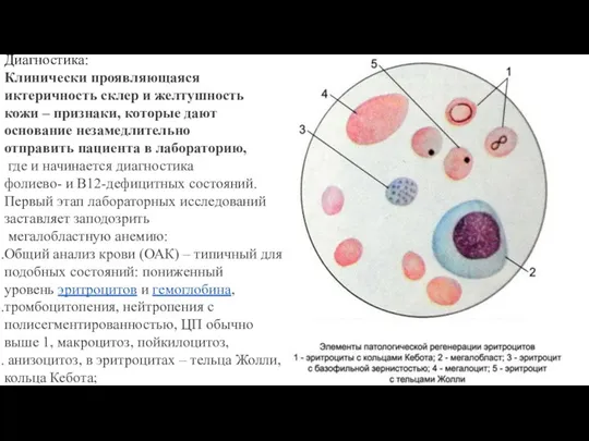 Диагностика: Клинически проявляющаяся иктеричность склер и желтушность кожи – признаки, которые дают