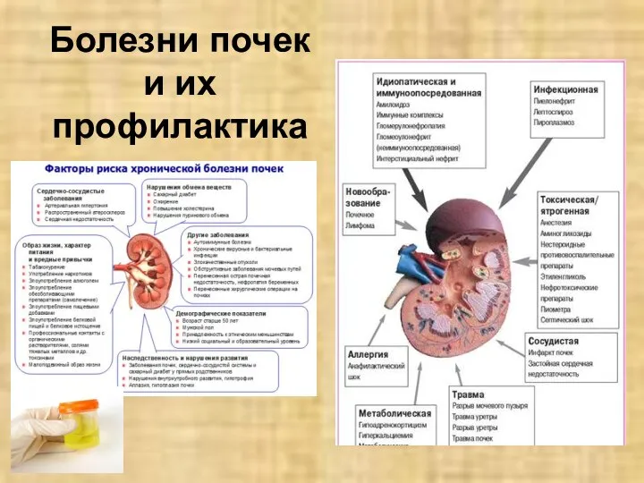 Болезни почек и их профилактика