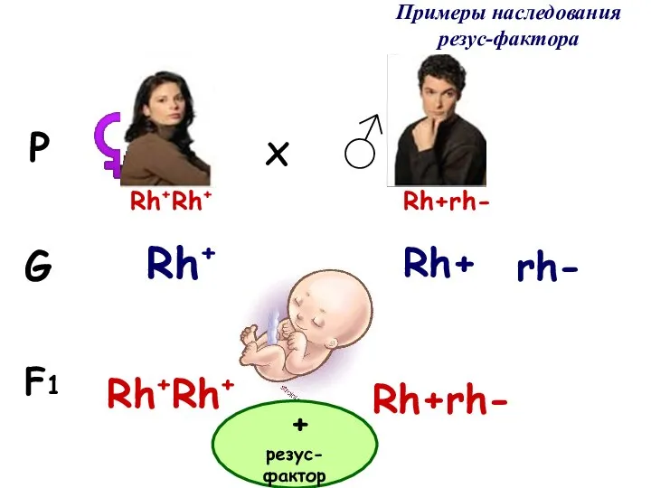Примеры наследования резус-фактора F1 G P ♀ ♂ x Rh+Rh+ Rh+rh- Rh+