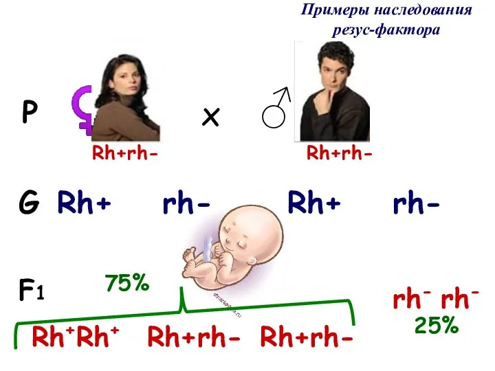 Примеры наследования резус-фактора F1 G P ♀ ♂ x Rh+rh- Rh+ rh-
