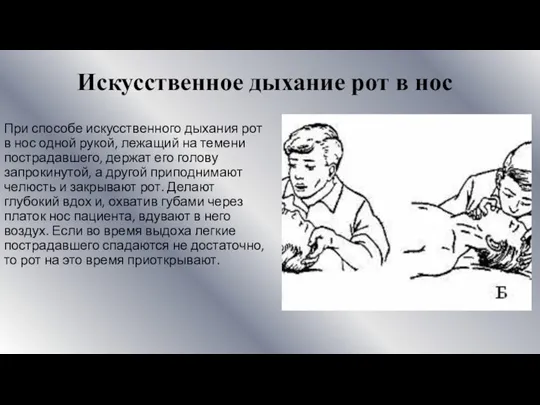 При способе искусственного дыхания рот в нос одной рукой, лежащий на темени