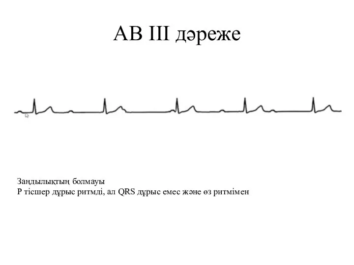 АВ III дәреже Заңдылықтың болмауы Р тісшер дұрыс ритмді, ал QRS дұрыс емес және өз ритмімен