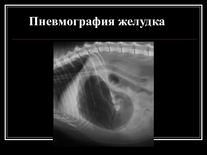 Пневмография желудка