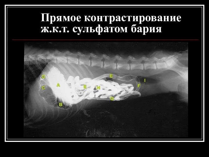 Прямое контрастирование ж.к.т. сульфатом бария