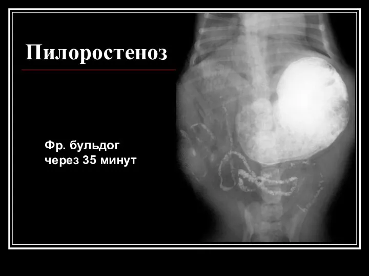 Пилоростеноз Фр. бульдог через 35 минут