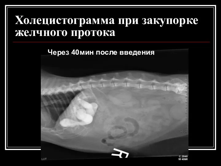 Холецистограмма при закупорке желчного протока Через 40мин после введения