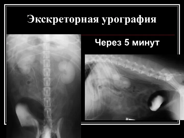 Экскреторная урография Через 5 минут