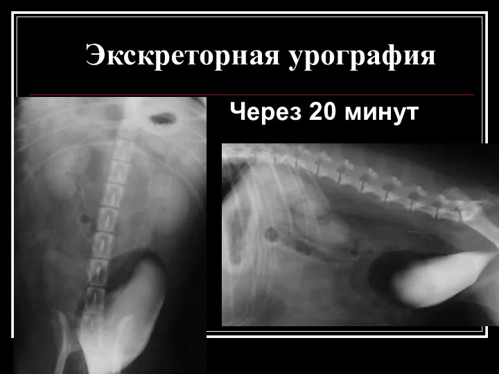 Экскреторная урография Через 20 минут