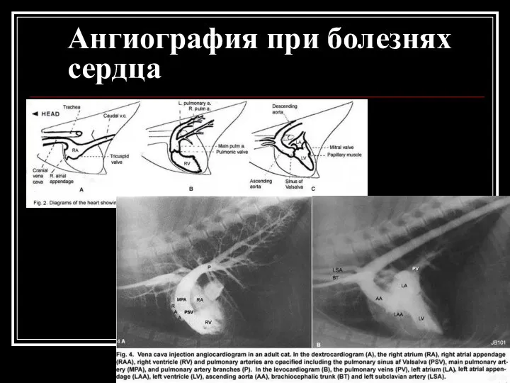 Ангиография при болезнях сердца